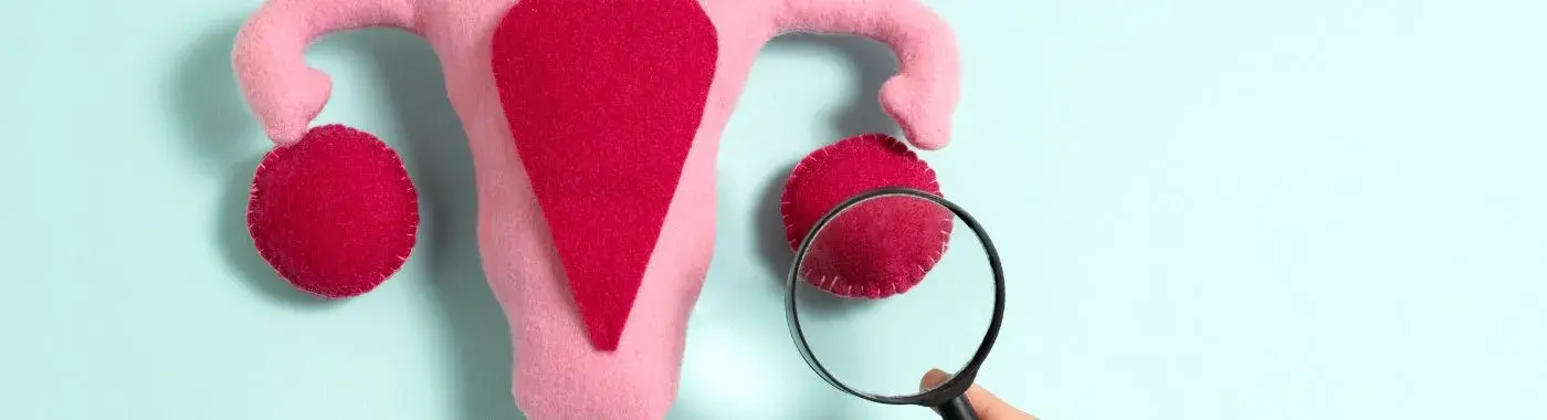 Ovarian Dermoid Cyst - Causes, Symptoms, Diagnosis, Treatment, and Prevention