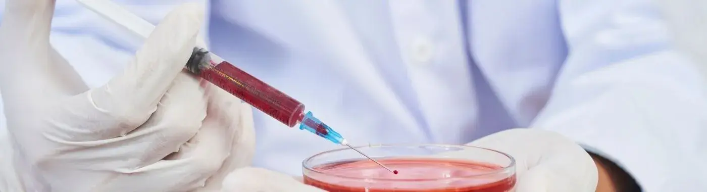 Plasmacytoma - Causes, Symptoms, Diagnosis, Treatment, and Prevention