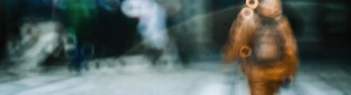 Posterior Capsular Opacification - Causes, Symptoms, Diagnosis, Treatment, and Prevention