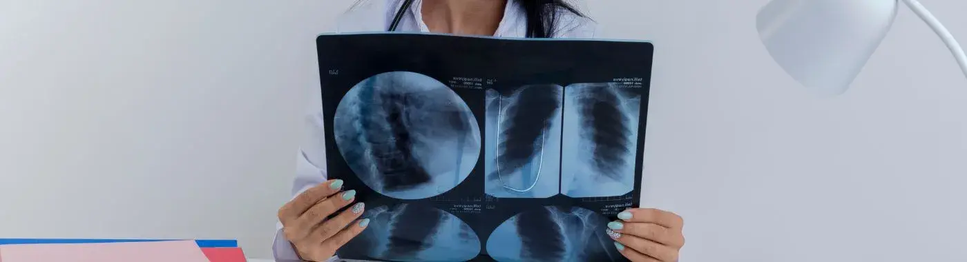 Pulmonary Contusion - Causes, Symptoms, Diagnosis, Treatment, and Prevention