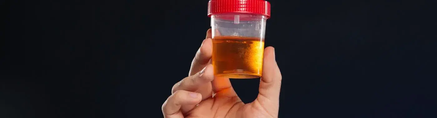 Pyuria - Causes, Symptoms, Diagnosis, Treatment, and Prevention