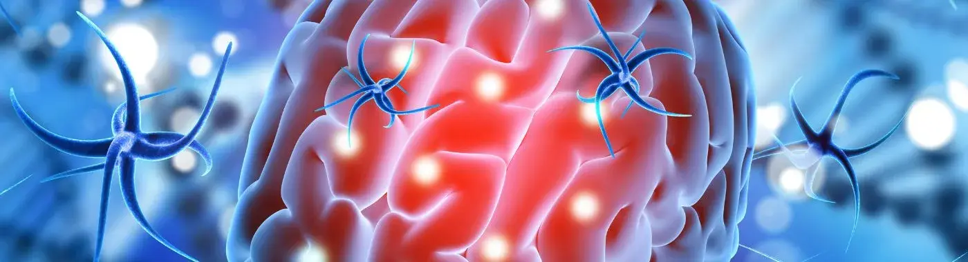 Schwannoma - Causes, Symptoms, Diagnosis, Treatment, and Prevention