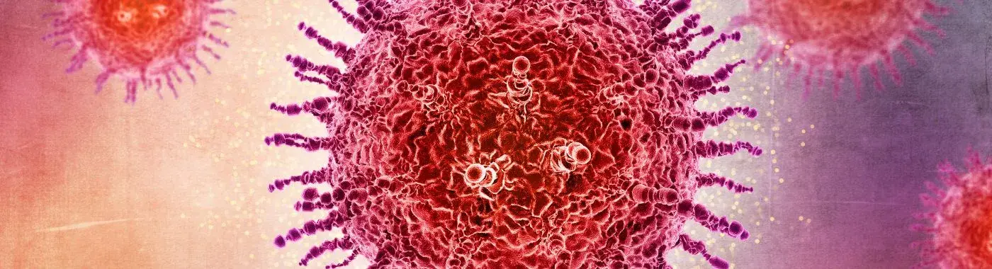 Signet Ring Cell Carcinoma - Causes, Symptoms, Diagnosis, Treatment, and Prevention