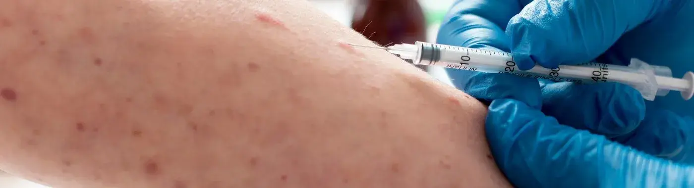 Small pox - Causes, Symptoms, Diagnosis, Treatment, and Prevention