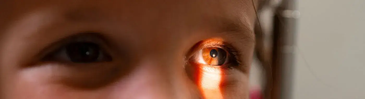 Solar Retinopathy - Causes, Symptoms, Diagnosis, Treatment, and Prevention