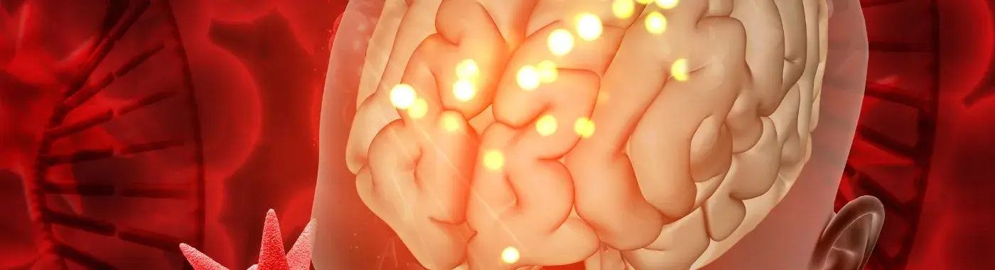 Stroke - Types, Symptoms and Treatment