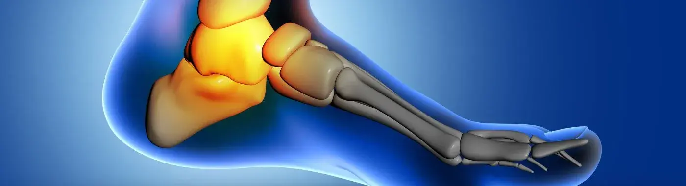 Tarsal Coalition - Causes, Symptoms, Diagnosis, Treatment, and Prevention