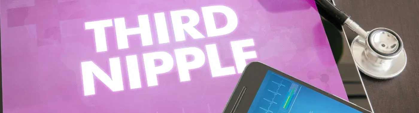 Third Nipple - Causes, Symptoms, Diagnosis, Treatment, and Prevention