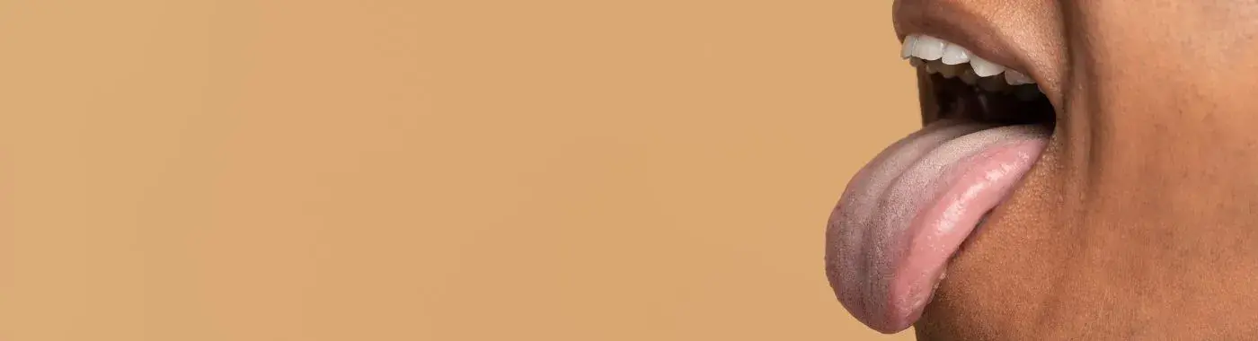 Thrush - Causes, Symptoms, Diagnosis, Treatment, and Prevention