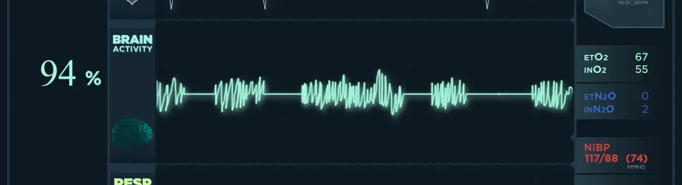 Torsades De Pointes - Causes, Symptoms, Diagnosis, Treatment, and Prevention