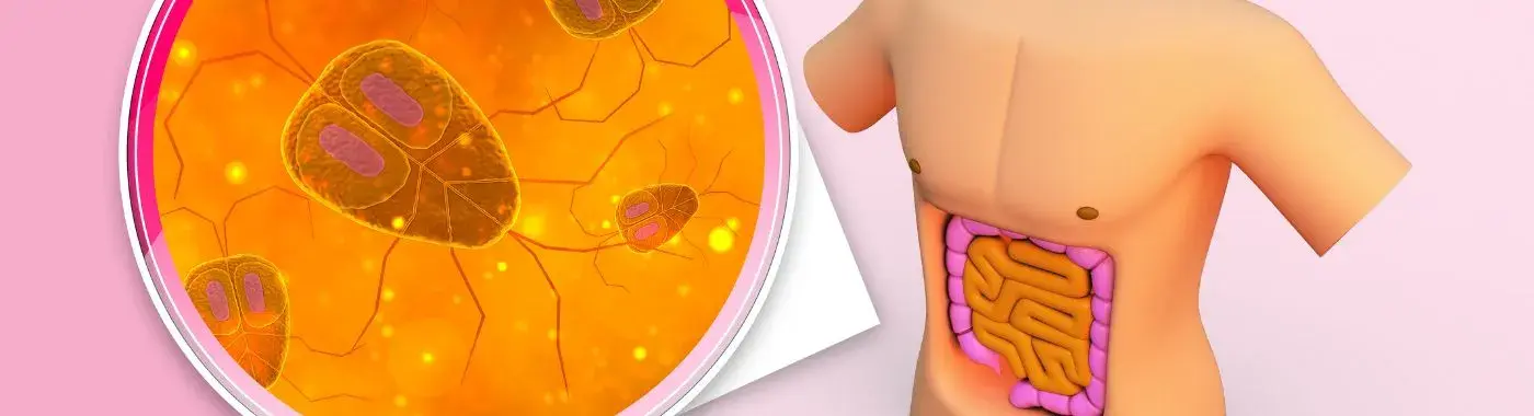 Toxic Megacolon - Causes, Symptoms, Diagnosis, Treatment, and Prevention