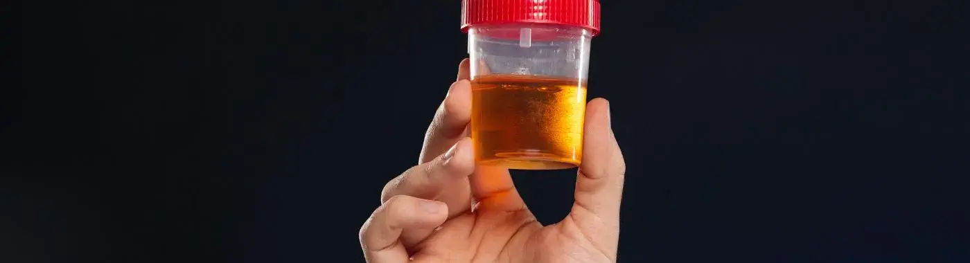 Urosepsis - Causes, Symptoms, Diagnosis, Treatment, and Prevention