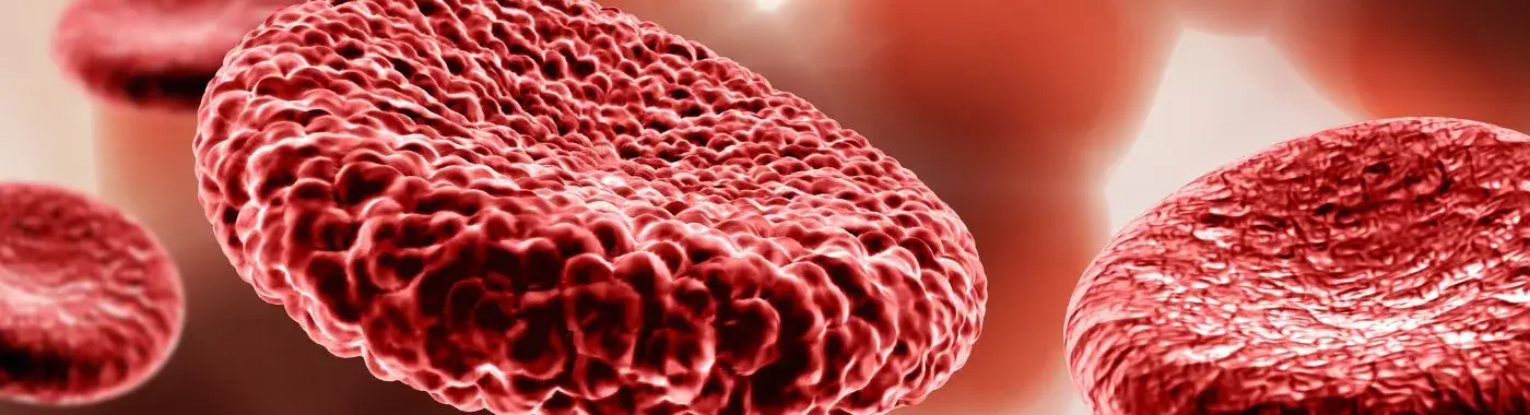 Vasodilation - Causes, Symptoms, Diagnosis, Treatment, and Prevention