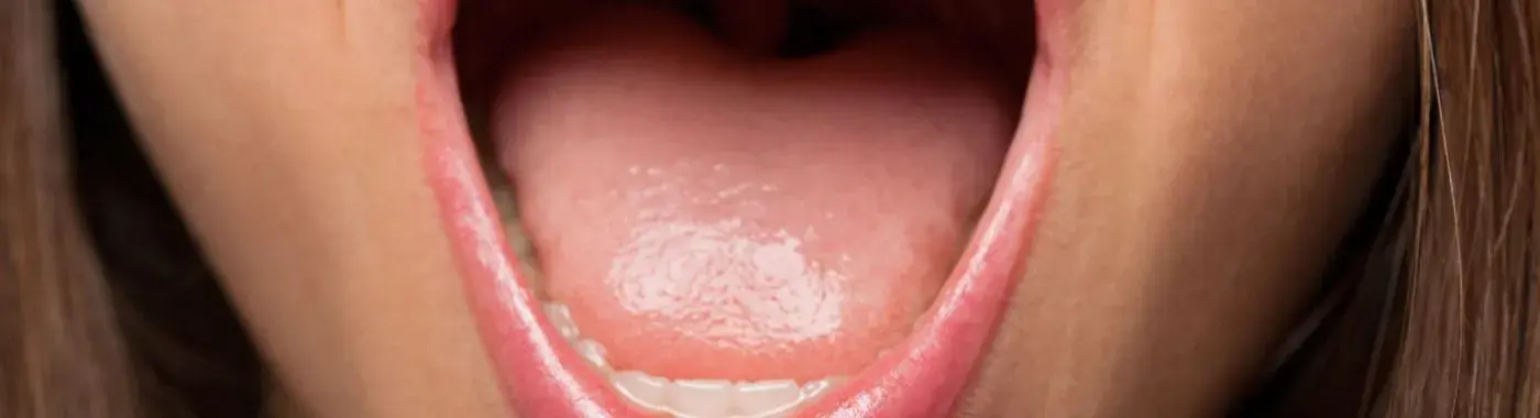 Verrucous Carcinoma - Causes, Symptoms, Diagnosis, Treatment, and Prevention