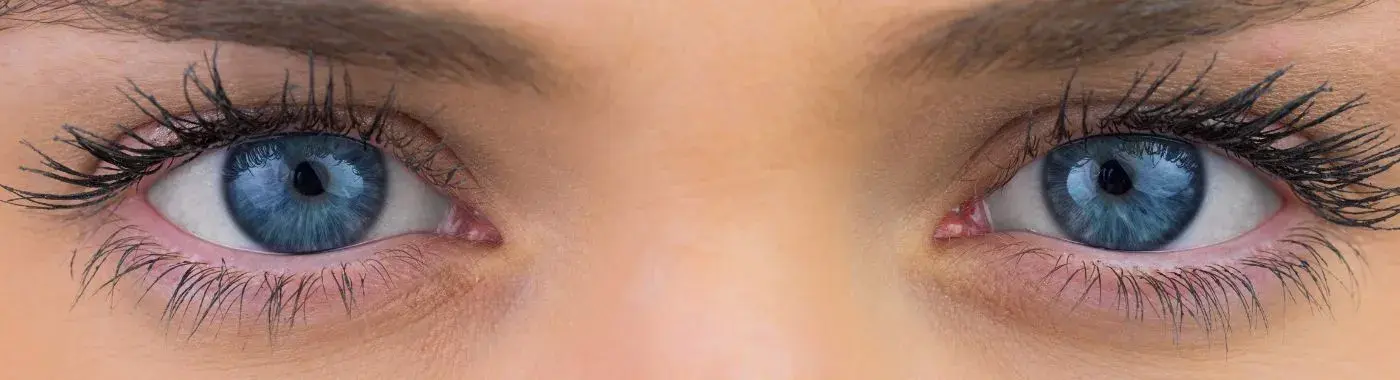 Argyll Robertson Pupil