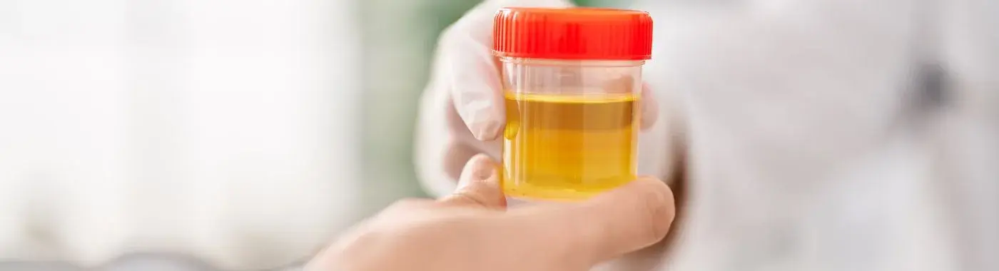 Cloudy urine