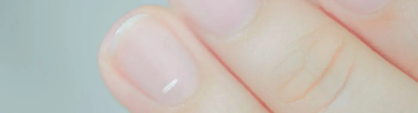 White spots on nails