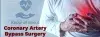 Coronary Artery Bypass Grafting (CABG) Surgery