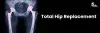 Total Hip Replacement (THR) 