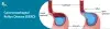 Gastroesophageal Reflux Disease (GERD)