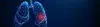 Lung Cancer - Early Signs, Risk Factors, Diagnosis, and Treatment Explained