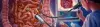 Colonoscopy - Procedures, Preparation, Cost, and Recovery