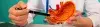 Laparoscopic Adjustable Gastric Banding (LAGB) - Procedures, Preparation, Cost, and Recovery