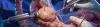 Laparoscopic Appendectomy - Procedures, Preparation, Cost, and Recovery