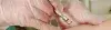 Loop Electrosurgical Excision Procedure (LEEP) - Procedures, Preparation, Cost, and Recovery