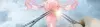 Ovarian Cancer Surgery- Procedure, Cost in India, Risks, Recovery and benefits