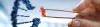 Preimplantation Genetic Diagnosis (PGD) - Procedures, Preparation, Cost, and Recovery