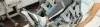 Robotic Hip Replacement Surgery - Procedures, Preparation, Cost, and Recovery