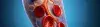 Thrombolysis - Procedures, Preparation, Cost, and Recovery