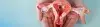 Vaginal Hysterectomy - Procedures, Preparation, Cost, and Recovery