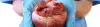 Balloon Septostomy - Cost, Indications, Preparation, Risks, and Recovery
