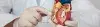 What is Anorectal Malformation Repair