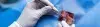 What is Anorectal Malformation Repair