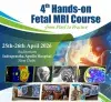 fetal-mri.png