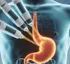 Upper GI Endoscopy thumbnail