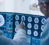Brain Cancer thumbnail
