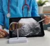 Liver Cancer thumbnail