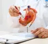 Stomach Cancer thumbnail
